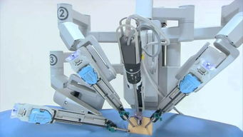 機(jī)器人制霸手術(shù)臺 外企壟斷格局下，國產(chǎn)普通機(jī)械制造的突圍之路